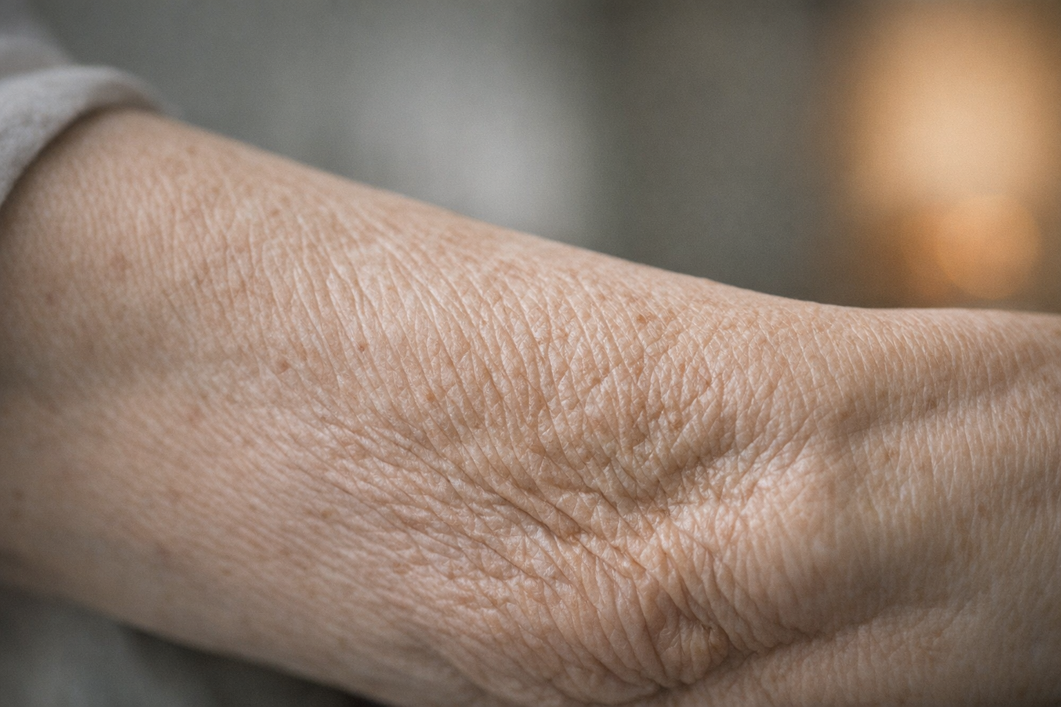 Close-up of crepey skin on an arm.